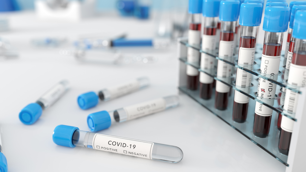 Covid-19 Dépistage